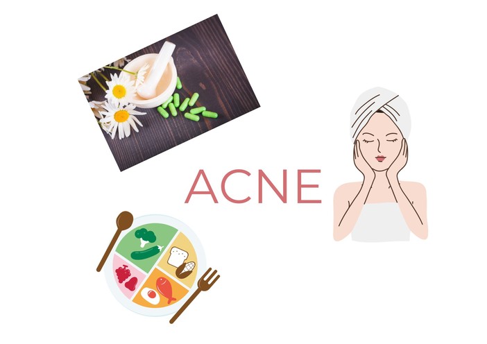 Acne: integrazione, alimentazione e skincare